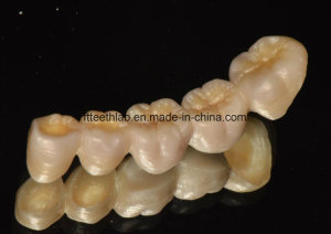 Full Contour Zirconium Bridge Made in China Dental Lab